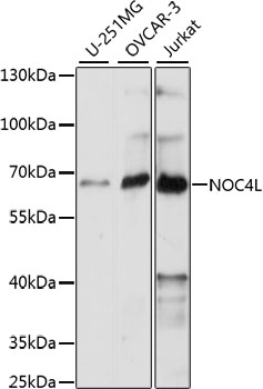 NOC4L Antibody - Western blot analysis of extracts of various cell lines, using NOC4L antibody at 1:1000 dilution. The secondary antibody used was an HRP Goat Anti-Rabbit IgG (H+L) at 1:10000 dilution. Lysates were loaded 25ug per lane and 3% nonfat dry milk in TBST was used for blocking. An ECL Kit was used for detection and the exposure time was 90s.