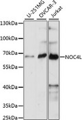NOC4L Antibody - Western blot analysis of extracts of various cell lines, using NOC4L antibody at 1:1000 dilution. The secondary antibody used was an HRP Goat Anti-Rabbit IgG (H+L) at 1:10000 dilution. Lysates were loaded 25ug per lane and 3% nonfat dry milk in TBST was used for blocking. An ECL Kit was used for detection and the exposure time was 90s.