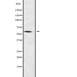 NOC4L Antibody - Western blot analysis of NOC4L expression in NOC4L transfected 293T cells lysate. The lane on the left is treated with the antigen-specific peptide.