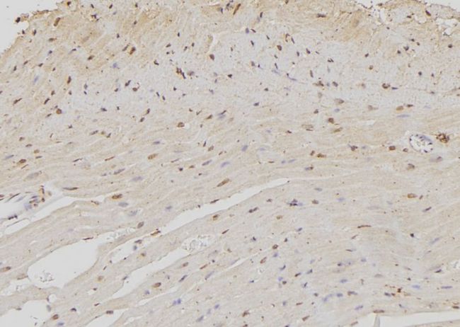 NOC4L Antibody - 1:100 staining rat heart tissue by IHC-P. The sample was formaldehyde fixed and a heat mediated antigen retrieval step in citrate buffer was performed. The sample was then blocked and incubated with the antibody for 1.5 hours at 22°C. An HRP conjugated goat anti-rabbit antibody was used as the secondary.
