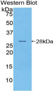 NOD1 Antibody - Western blot of recombinant NOD1.  This image was taken for the unconjugated form of this product. Other forms have not been tested.