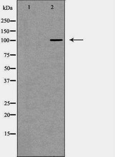 NOD1 Antibody - Western blot analysis of mouse bladder lysate using NOD1 antibody. The lane on the left is treated with the antigen-specific peptide.