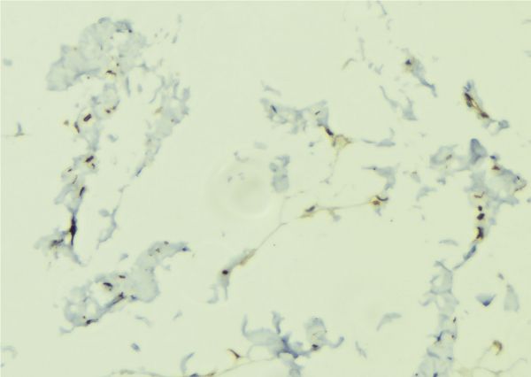 NOD1 Antibody - 1:100 staining human lung tissue by IHC-P. The sample was formaldehyde fixed and a heat mediated antigen retrieval step in citrate buffer was performed. The sample was then blocked and incubated with the antibody for 1.5 hours at 22°C. An HRP conjugated goat anti-rabbit antibody was used as the secondary.