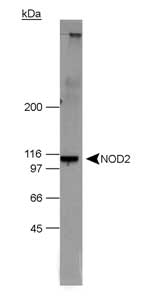 NOD2 / CARD15 Antibody - Detection of NOD2 in 20 ug of NOD2 transfected 293T cell lysate. ECL detection in 15 seconds.  This image was taken for the unconjugated form of this product. Other forms have not been tested.
