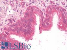 NOD2 / CARD15 Antibody - Human Lung: Formalin-Fixed, Paraffin-Embedded (FFPE)