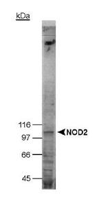 NOD2 / CARD15 Antibody - Detection of endogenous NOD2 in 50 ug of HT29 cell lysate. ECL detection in 15 minutes.  This image was taken for the unconjugated form of this product. Other forms have not been tested.