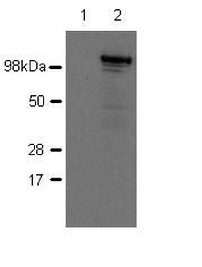 NOD2 / CARD15 Antibody - Nod2 Antibody in Western Blot (WB)