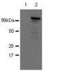 NOD2 / CARD15 Antibody - Nod2 Antibody in Western Blot (WB)