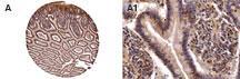 NOD2 / CARD15 Antibody - Fig-2: Formalin-fixed, paraffin-embedded normal human colon stained for NOD2 expression using at 1:2000. A, tissue core from a colon tissue microarray. A1, high magnification of A. Hematoxylin-eosin counterstain.