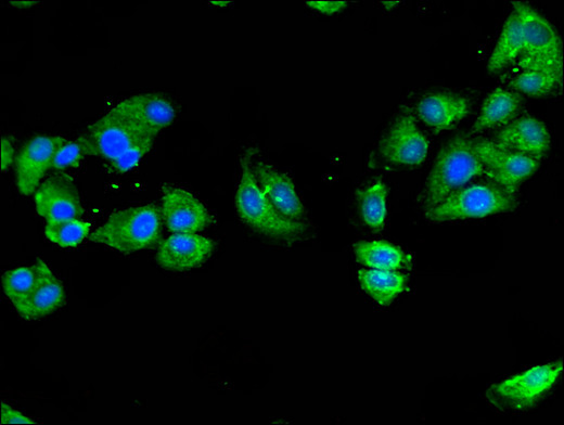NOD2 / CARD15 Antibody - Immunofluorescent analysis of HepG2 cells using NOD2 Antibody at a dilution of 1:100 and Alexa Fluor 488-congugated AffiniPure Goat Anti-Rabbit IgG(H+L)