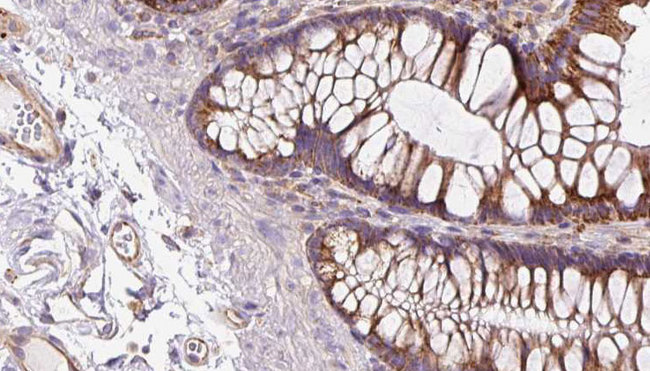 NOD2 / CARD15 Antibody - 1:100 staining mouse colon tissue by IHC-P. The sample was formaldehyde fixed and a heat mediated antigen retrieval step in citrate buffer was performed. The sample was then blocked and incubated with the antibody for 1.5 hours at 22°C. An HRP conjugated goat anti-rabbit antibody was used as the secondary.
