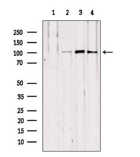 NOD2 / CARD15 Antibody - Western blot analysis of extracts of various samples using NOD2 antibody. Lane 1: HeLa treated with blocking peptide. Lane 2: HeLa; Lane 3: mouse Myeloma cells; Lane 4: mouse lung;