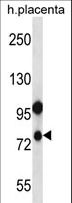 NOD8 / NLRP10 Antibody - NLRP10 Antibody western blot of human placenta tissue lysates (35 ug/lane). The NLRP10 antibody detected the NLRP10 protein (arrow).