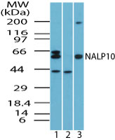 NOD8 / NLRP10 Antibody - Western blot of NALP10 in HeLa cell lysate in the 1) absence and 2) presence of immunizing peptide and 3) RAW cell lysate using Polyclonal Antibody to NALP10 at 1.0 ug/ml. Goat anti-rabbit Ig HRP secondary antibody, and PicoTect ECL substrate solution, were used for this test.