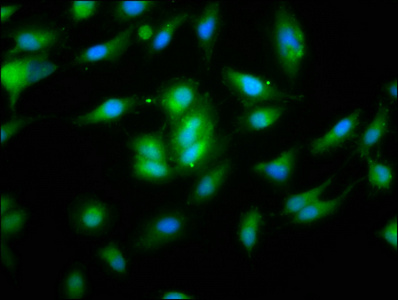 NOD8 / NLRP10 Antibody - Immunofluorescence staining of Hela cells at a dilution of 1:133, counter-stained with DAPI. The cells were fixed in 4% formaldehyde, permeabilized using 0.2% Triton X-100 and blocked in 10% normal Goat Serum. The cells were then incubated with the antibody overnight at 4 °C.The secondary antibody was Alexa Fluor 488-congugated AffiniPure Goat Anti-Rabbit IgG (H+L) .