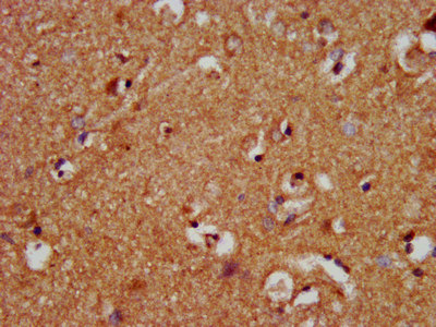 NOD8 / NLRP10 Antibody - Immunohistochemistry image at a dilution of 1:400 and staining in paraffin-embedded human brain tissue performed on a Leica BondTM system. After dewaxing and hydration, antigen retrieval was mediated by high pressure in a citrate buffer (pH 6.0) . Section was blocked with 10% normal goat serum 30min at RT. Then primary antibody (1% BSA) was incubated at 4 °C overnight. The primary is detected by a biotinylated secondary antibody and visualized using an HRP conjugated SP system.