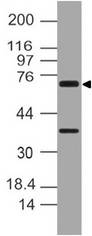 NOD8 / NLRP10 Antibody - Fig-1: Western blot analysis of NALP10. Anti-NALP10 antibody was used at 2 µg/ml on HepG2 lysate.