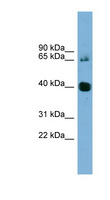 NODAL Antibody - NODAL antibody Western blot of Fetal Thymus lysate. This image was taken for the unconjugated form of this product. Other forms have not been tested.