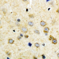 NODAL Antibody - Immunohistochemical analysis of NODAL staining in human brain formalin fixed paraffin embedded tissue section. The section was pre-treated using heat mediated antigen retrieval with sodium citrate buffer (pH 6.0). The section was then incubated with the antibody at room temperature and detected using an HRP polymer system. DAB was used as the chromogen. The section was then counterstained with hematoxylin and mounted with DPX.