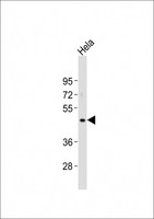 NODAL Antibody - Anti-NODAL Antibody at 1:2000 dilution + HeLa whole cell lysates Lysates/proteins at 20 ug per lane. Secondary Goat Anti-Rabbit IgG, (H+L), Peroxidase conjugated at 1/10000 dilution Predicted band size : 41 kDa Blocking/Dilution buffer: 5% NFDM/TBST.