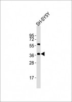 NODAL Antibody - Anti-Nodal Antibody at 1:2000 dilution + SH-SY5Y whole cell lysates Lysates/proteins at 20 ug per lane. Secondary Goat Anti-Rabbit IgG, (H+L), Peroxidase conjugated at 1/10000 dilution Predicted band size : 40 kDa Blocking/Dilution buffer: 5% NFDM/TBST.