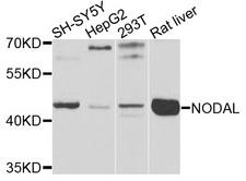 NODAL Antibody - Western blot analysis of extracts of various cells.