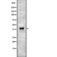 NODAL Antibody - Western blot analysis of NODAL using HeLa whole lysates.