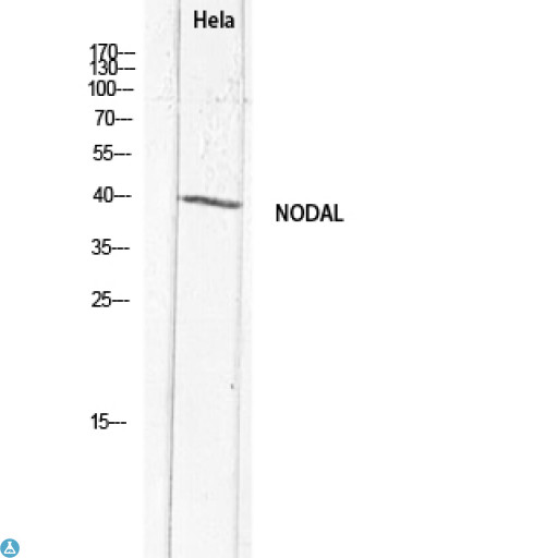 NODAL Antibody - Immunohistochemistry (IHC) analysis of paraffin-embedded Human Brain, antibody was diluted at 1:100.