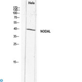 NODAL Antibody - Immunohistochemistry (IHC) analysis of paraffin-embedded Human Brain, antibody was diluted at 1:100.
