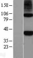 NODAL Protein - Western validation with an anti-DDK antibody * L: Control HEK293 lysate R: Over-expression lysate