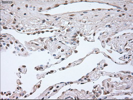 NOG / Noggin Antibody - IHC of paraffin-embedded Human lung tissue using anti-Nog mouse monoclonal antibody.