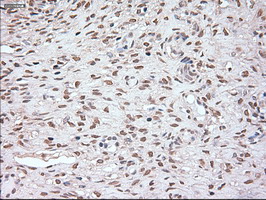NOG / Noggin Antibody - IHC of paraffin-embedded Human Ovary tissue using anti-Nog mouse monoclonal antibody.