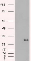 NOG / Noggin Antibody - HEK293T cells were transfected with the pCMV6-ENTRY control (Left lane) or pCMV6-ENTRY Noggin (Right lane) cDNA for 48 hrs and lysed. Equivalent amounts of cell lysates (5 ug per lane) were separated by SDS-PAGE and immunoblotted with anti-Noggin.