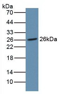 NOG / Noggin Antibody - Western Blot Rat Placenta Tissue Primary Ab: 2µg/mL Rabbit Anti-Human NOG Ab Second Ab: 1:5000 Dilution of HRP-Linked Rabbit Anti-Mouse IgG Ab