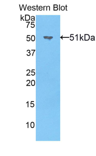 NOG / Noggin Antibody - Western blot of recombinant NOG / Noggin.  This image was taken for the unconjugated form of this product. Other forms have not been tested.