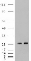 NOG / Noggin Antibody - HEK293T cells were transfected with the pCMV6-ENTRY control (Left lane) or pCMV6-ENTRY Nog (Right lane) cDNA for 48 hrs and lysed. Equivalent amounts of cell lysates (5 ug per lane) were separated by SDS-PAGE and immunoblotted with anti-Nog.