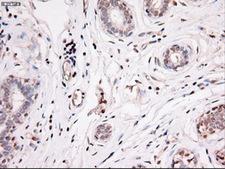 NOG / Noggin Antibody - Immunohistochemical staining of paraffin-embedded breast using anti-Nog mouse monoclonal antibody.
