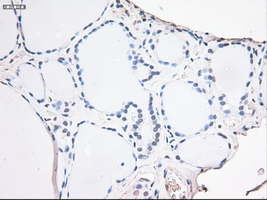 NOG / Noggin Antibody - Immunohistochemical staining of paraffin-embedded thyroid using anti-Nog mouse monoclonal antibody.