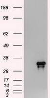 NOG / Noggin Antibody - HEK293T cells were transfected with the pCMV6-ENTRY control (Left lane) or pCMV6-ENTRY Noggin (Right lane) cDNA for 48 hrs and lysed. Equivalent amounts of cell lysates (5 ug per lane) were separated by SDS-PAGE and immunoblotted with anti-Noggin.