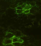 NOG / Noggin Antibody - Immunocytochemistry staining of HeLa cells surface-expressing Noggin-PDGFR transmembrane domain fused protein using Noggin mouse monoclonal antibody (dilution 1:100).