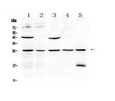NOG / Noggin Antibody - Western blot - Anti-Noggin Picoband Antibody