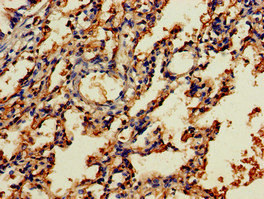 NOG / Noggin Antibody - Immunohistochemistry of paraffin-embedded human lung tissue at dilution of 1:100