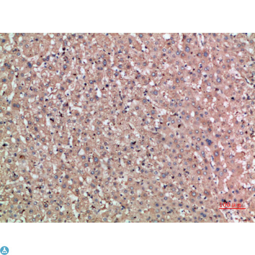 NOG / Noggin Antibody - Immunohistochemical analysis of paraffin-embedded human-liver, antibody was diluted at 1:200.