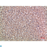 NOG / Noggin Antibody - Immunohistochemical analysis of paraffin-embedded human-liver, antibody was diluted at 1:200.