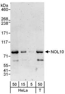 NOL10 Antibody - Detection of Human NOL10 by Western Blot. Samples: Whole cell lysate from HeLa (5, 15 and 50 ug) and 293T (T; 50 ug) cells. Antibody: Affinity purified rabbit anti-NOL10 antibody used at 0.1 ug/ml. Detection: Chemiluminescence with an exposure time of 3 minutes.