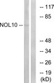 NOL10 Antibody - Western blot analysis of lysates from HUVEC cells, using NOL10 Antibody. The lane on the right is blocked with the synthesized peptide.