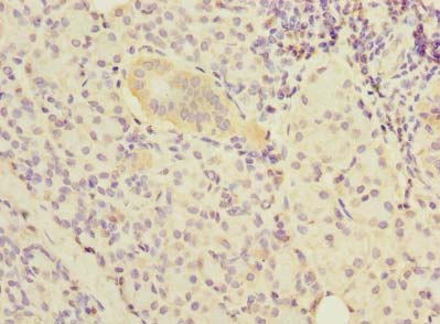 NOL10 Antibody - Immunohistochemistry of paraffin-embedded human pancreatic tissue using antibody at dilution of 1:100.
