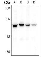 NOL10 Antibody - Western blot analysis of NOL10 expression in A549 (A), HepG2 (B), PC12 (C), AML12 (D) whole cell lysates.