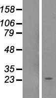NOL12 Protein - Western validation with an anti-DDK antibody * L: Control HEK293 lysate R: Over-expression lysate
