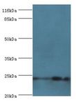 NOL3 / ARC Antibody - Western blot. All lanes: Nucleolar protein 3 antibody at 2 ug/ml. Lane 1: mouse skeletal muscle tissue Lane 2: HeLa whole cell lysate. Secondary antibody: goat polyclonal to rabbit at 1:10000 dilution. Predicted band size: 24 kDa. Observed band size: 24 kDa.  This image was taken for the unconjugated form of this product. Other forms have not been tested.